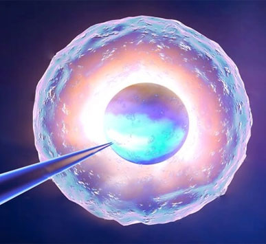 Laser Assisted Hatching